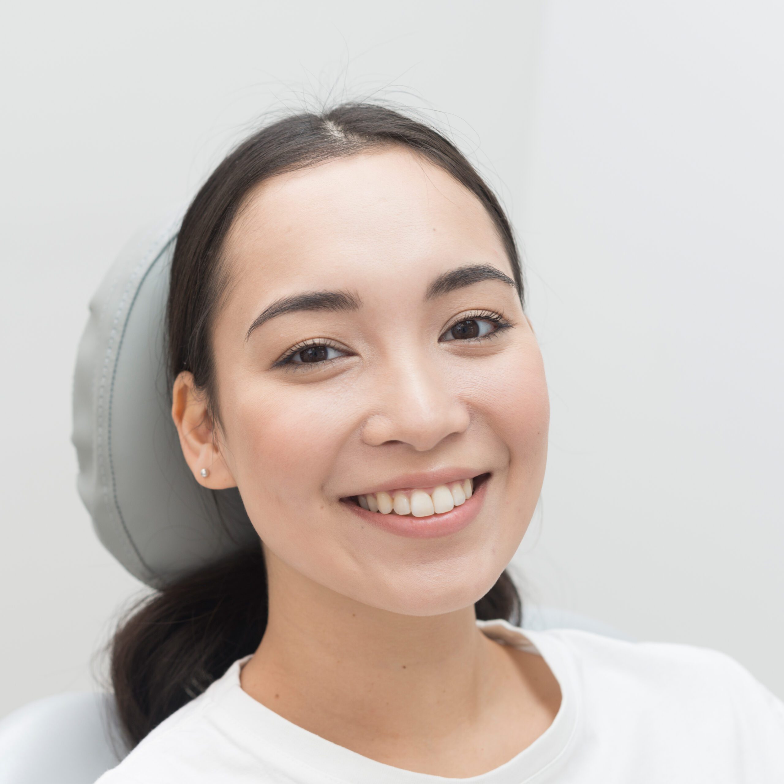 Rejuvie Aesthetic & Dermatology Bali Dental SMile Makeover model